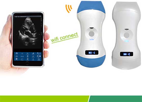Wireless Ultrasound solutions